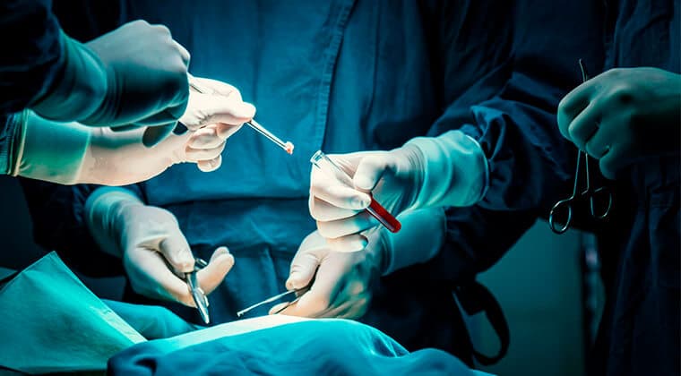 Biopsias quirúrgicas