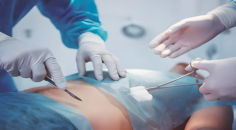 Cirugía de emergencia abdominal