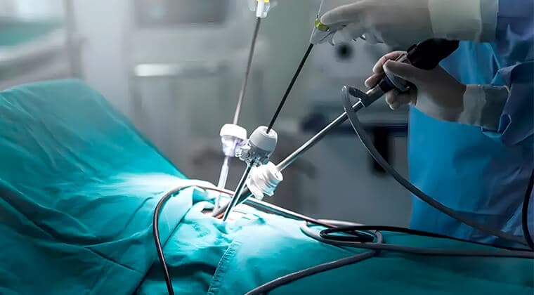 Cirugía laparoscópica (técnica de mínima invasión)